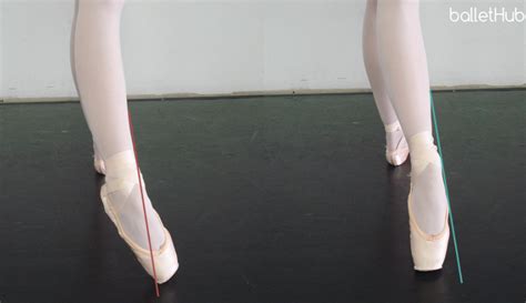 What Does “Sickled Feet” Mean in Dance? A Complex Examination